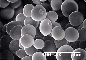 「平成宮崎酵母」の電子顕微鏡写真